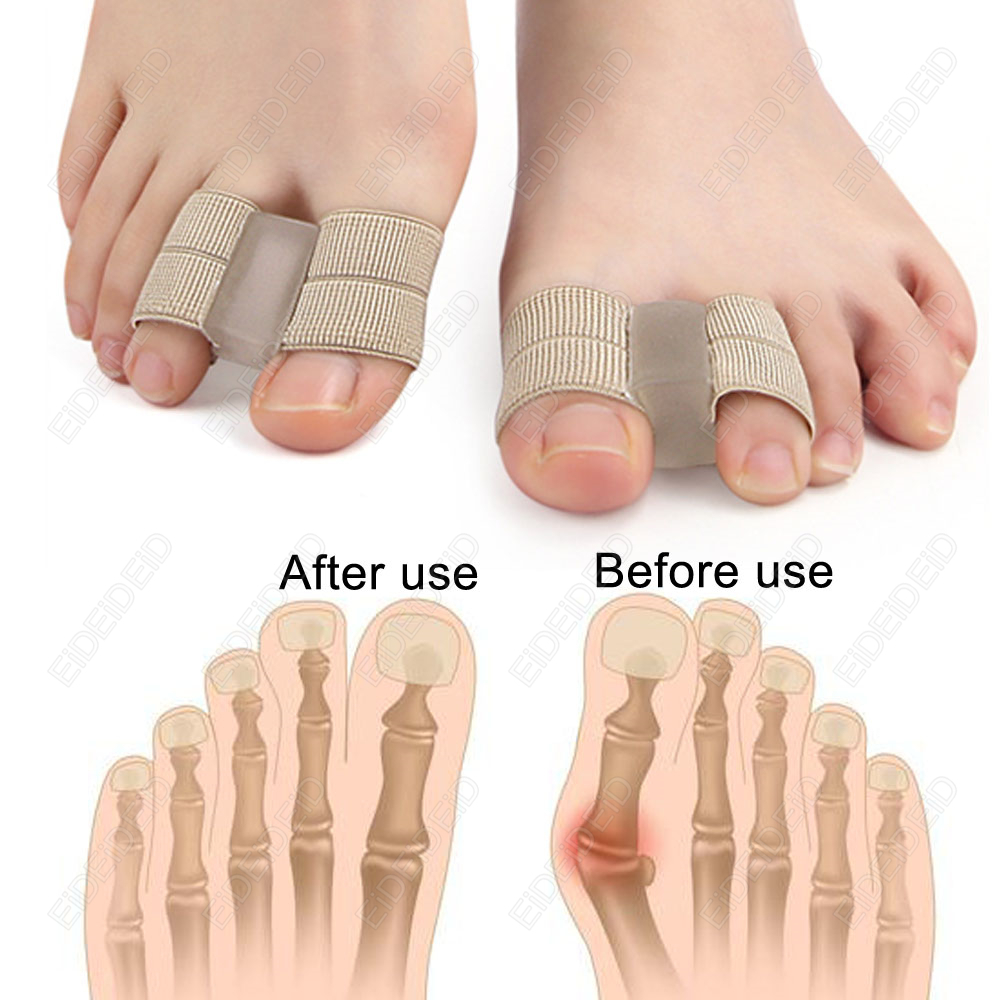 Correcteur d'oignon, orthèses  - Women'S Shoes With Bunions avis et prix